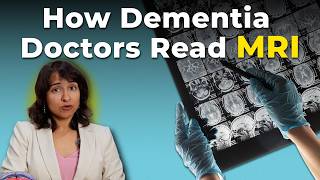 MRI Report Says “Atrophy” or “White Matter Disease”? What I Look For as a Dementia Doctor