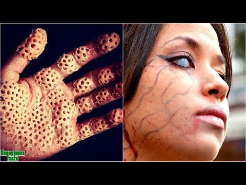 10 უცნაური და იშვიათი ფობია