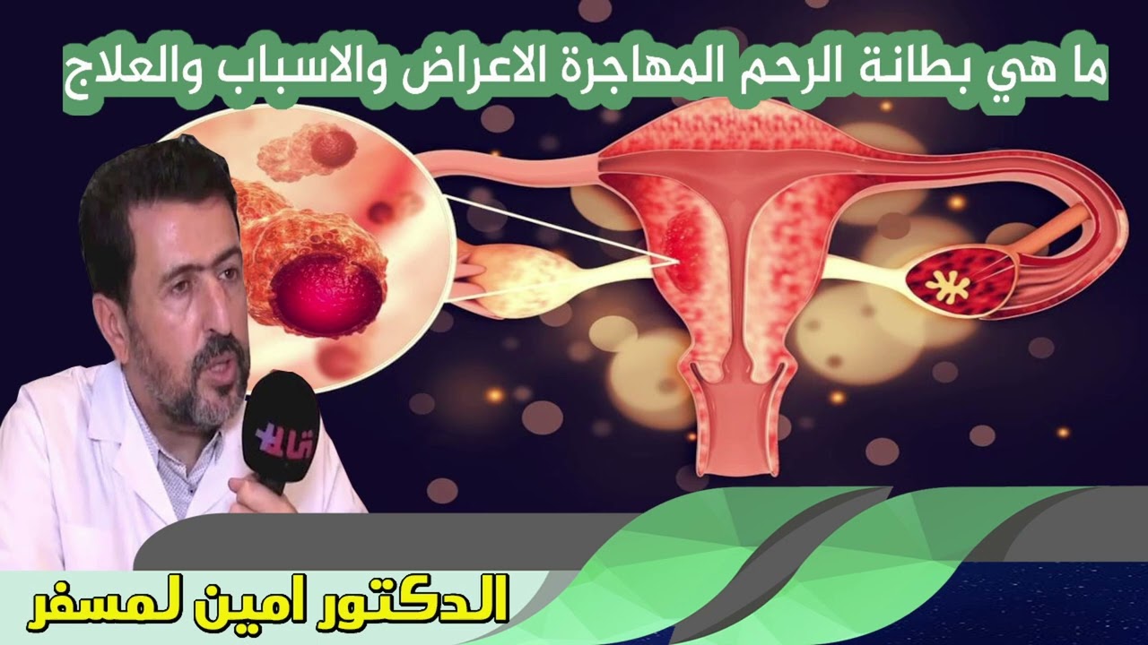 ما هي بطانة الرحم المهاجرة الاعراض والاسباب والعلاج الدكتور امين لمسفر