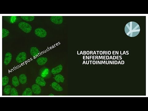 Vídeo: Compromiso Hepático En Sujetos Con Enfermedad Reumática