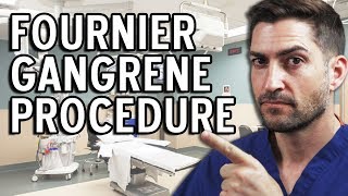 Fournier Gangrene Procedure - Brace Yourselves For This Story!