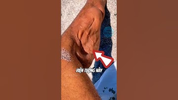 Cách xử lí khi bạn bị chuột rút | #bientrithuc #amazingfacts