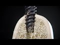 Straumann blx implant system  full length chip flutes dynamic bone management
