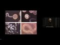 Diarrhoea in macropods - Dr Howard Ralph, Southern Cross Wildlife Hospital