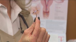 CDC recommends doctors inform women about IUD pain