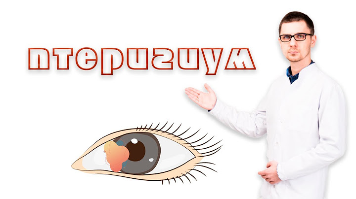 Птеригиум или пленка на глазу