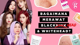 Cara Hilangkan Blackhead dan Whitehead. Perlu Pakai Produk Apa?