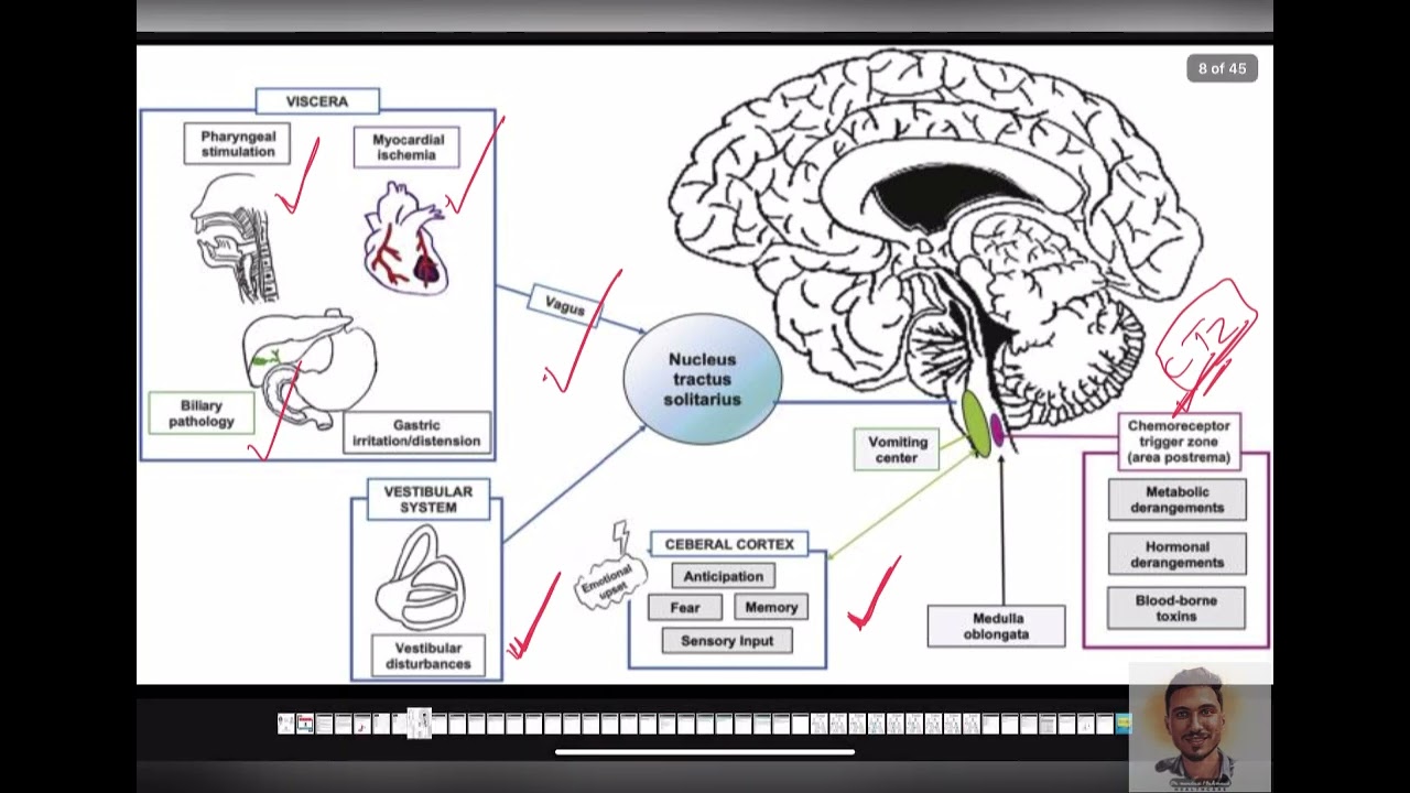 Nausea and vomiting internal medicine dr Moataz mahmoud