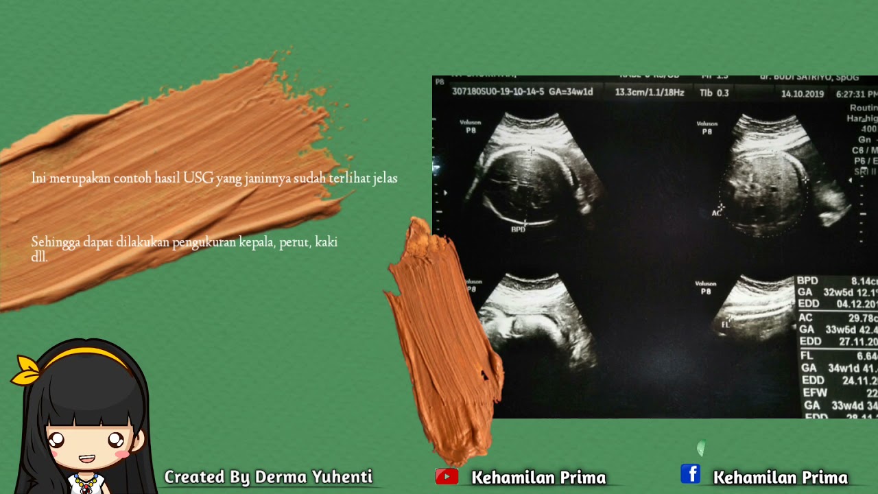 CARA MEMBACA HASIL USG