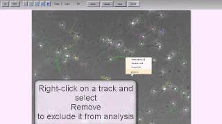 MMC Sperm: sperm motility analysis using phase contrast microscope