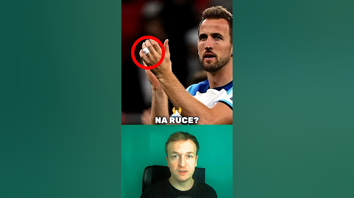 Proč si fotbalisti zalepují PRSTY? ⚽️😱