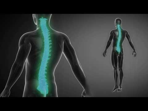 Musculoskeletal disorders (MSDs)