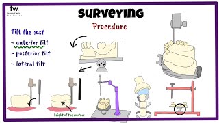Surveyor and Surveying in RPD | Prosthodontics screenshot 5