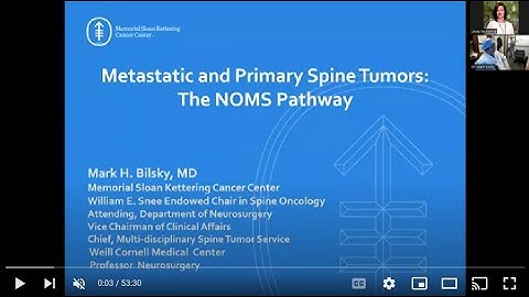 Neuro Lecture: Spinal Cord Compression and Treatment Decisions with Dr Mark Bilsky