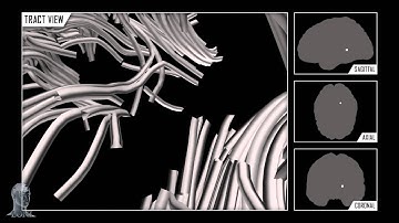 Navigating The Connectome