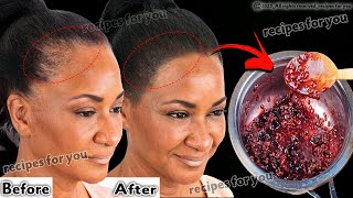I Tried This And My Hair Growth Got Doubled In 1 Month - Increase Hair Density With Double Hair Growth