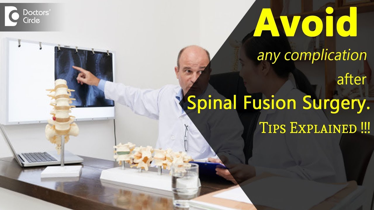 Complications of Spinal Fusion years after the surgery - Dr. Kodlady ...