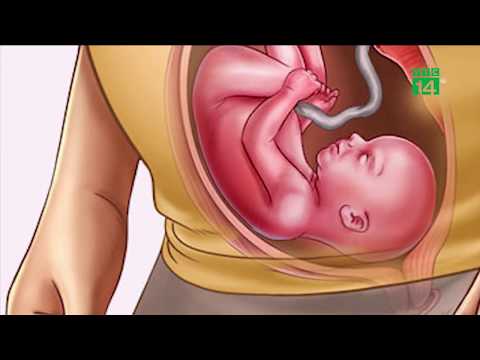 Phá Thai 1 Tuần Tuổi Có Tội Không - Phá thai được 1 tuần, bà bầu phát hiện đứa bé vẫn trong bụng | VTC14