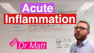 Acute Inflammation | Immunology