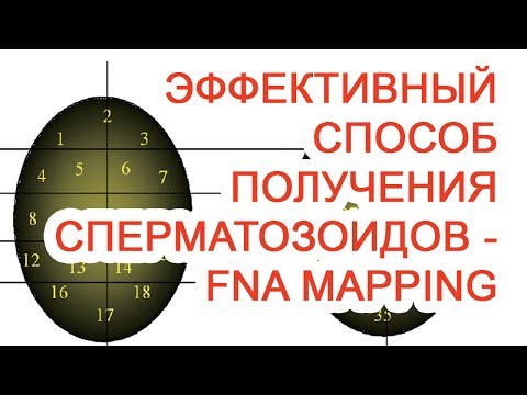 Эффективный способ получения сперматозоидов – FNA Mapping / Доктор Черепанов