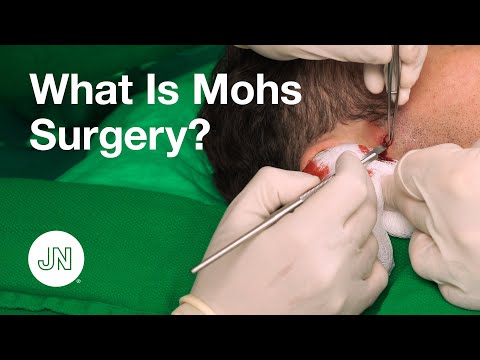 What is Mohs Surgery?