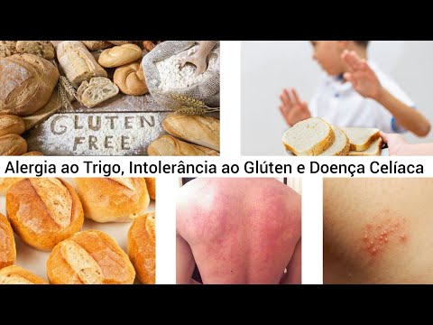 Alergia ao Trigo X Intolerância ao Glúten X Doença Celíaca