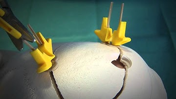 Cranial LOOP - Quick start