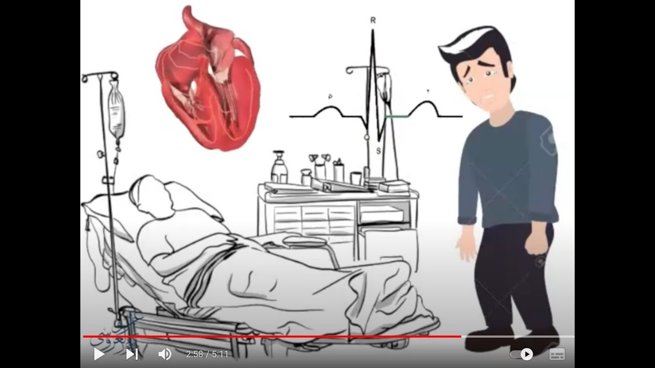 القتل الرحيم