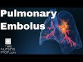 Pulmonary Embolus Nursing Care