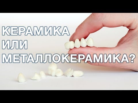 Керамика или металлокерамика, что лучше выбрать?