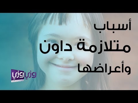 فيديو: ما مدى دقة العلامات اللينة لمتلازمة داون؟