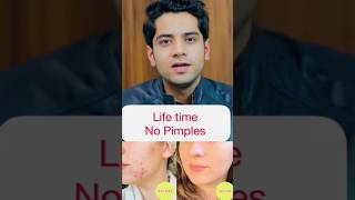 Pimples को करे हमेशा के लिए खतम वो भी 1 दिन मै☑️🤔|| #skincare #shorts #viral #trending #acne #top