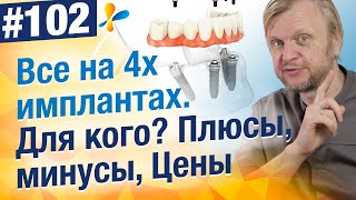 Самое главное о протезировании &quot;Все на 4х&quot;. Преимущества и недостатки. Сколько стоит?