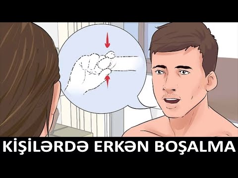 Video: Təcili kontraseptiv həbləri necə almaq olar (şəkillərlə birlikdə)