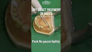 Dry socket treatment on model #shorts screenshot 3