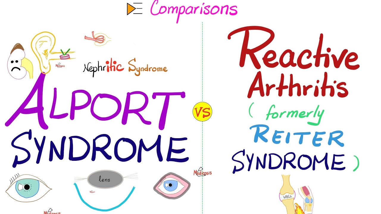 Alport Syndrome vs Reactive Arthritis (Nephritis vs Arthritis) | 2 Triads | Comparisons