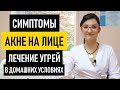 Что такое акне на лице. Про лечение акне в домашних условиях, выдавливание и удаление акне