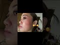 My Skin Is Not Perfect But At Least You See The Difference Right Skincare Acneproneskin My Skin Is Not Perfect But At Least You See The Difference Right Skincare Acneproneskin