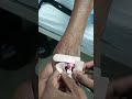 cannula हो गया fix😱😱#hospital #viralsong #doctor #medical #medicaltutorial #