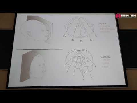 Video 32. Siêu âm não xuyên thóp - ThS.BS Nguyễn Thị Thùy... - youtube