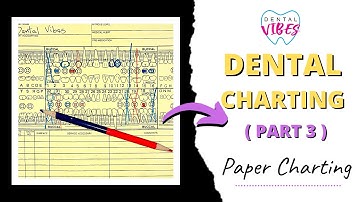 PAPER CHARTING FOR DENTAL ASSISTANTS // PART 3 // Paper charting