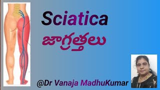 Sciatica pain relief exercises and Sciatica nerve stretching