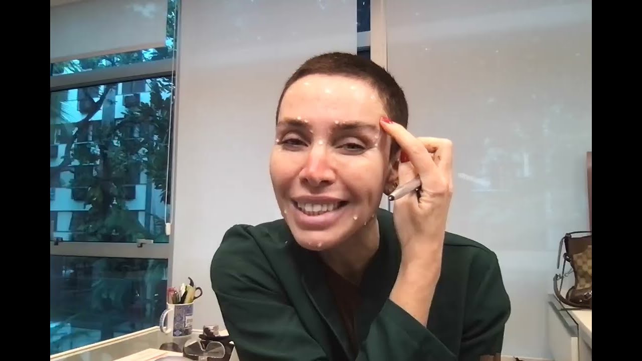 Afinal o que é botox full face?