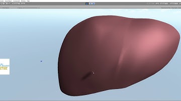 Virtual Surgery----Liver deformation