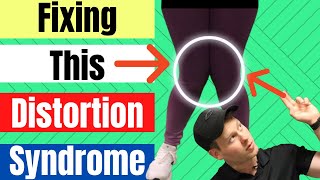 Pronation Distortion Syndrome | Pes Planus Distortion Syndrome | How To Fix Them