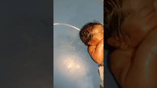 Nurse clean the newborn baby just after immediately birth of cute baby lot of vernix and coseaease