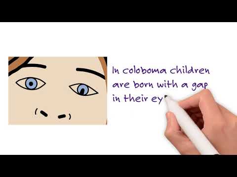 Video: Anophthalmia - Symptoms, Treatment, Forms, Stages, Diagnosis