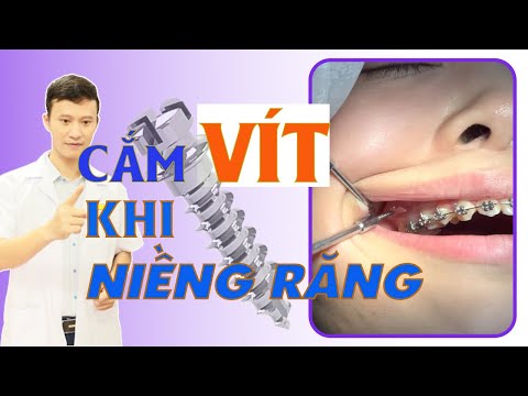 Video Gây Tê Và Cắm Vít Trong Chỉnh Nha | Cận Cảnh Cắm... - youtube