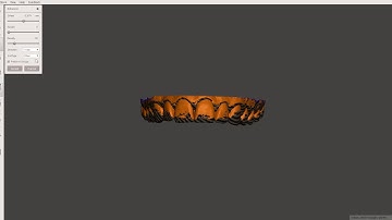 Basing dental model in Meshmixer