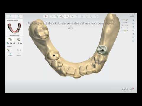 Webinar: Implant Studio (German)